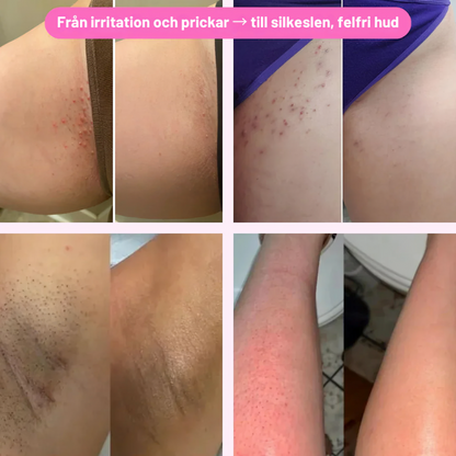 SilkGlide Pro™ - Bikini & Body Trimmer